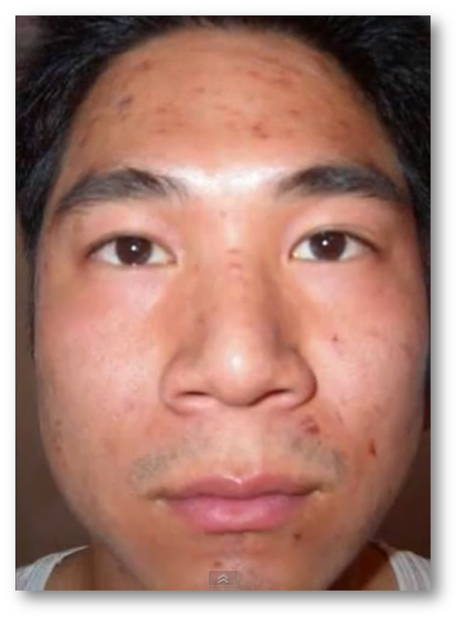 Winter 2006 Profile Picture Before and After